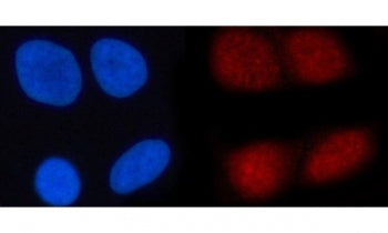 N4BP1 Antibody / NEDD4-binding protein 1 / KIAA0615