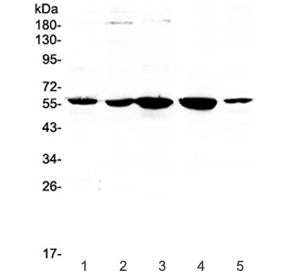 ETV6 Antibody / Tel