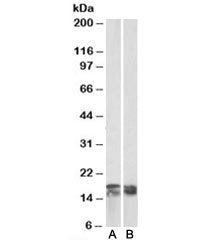 CD3 zeta Antibody