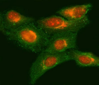 METTL11A Antibody / NRMT / NTMT1