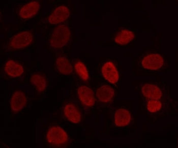 LRIG2 Antibody / Leucine-rich repeats and immunoglobulin-like domains protein 2