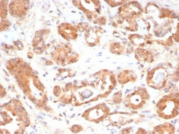 MIF Antibody / Macrophage migration inhibitory factor