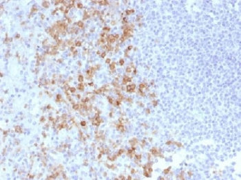 CD162 Antibody / P selectin glycoprotein ligand 1 / PSGL-1