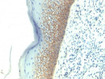 IHC testing of FFPE human skin with E-Cadherin antibody (clone SPM381). Required HIER: boil tissue s