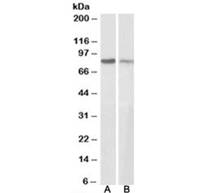 Gamma-catenin Antibody