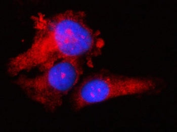 Immunofluorescent staining of FFPE human PC-3 cells with RPS17 antibody (red) and DAPI nuclear stain