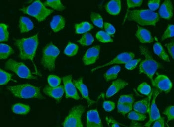 ACADM Antibody / Mcad