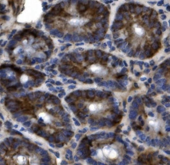 Slc44a2 Antibody / Ctl2