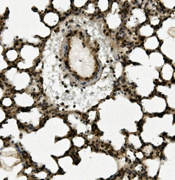 Aryl Hydrocarbon Receptor Antibody / AHR