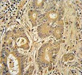 IMMT Antibody / MIC60