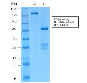 SDS-PAGE analysis of purified, BSA-free recombinant Catenin gamma antibody (clone CTNG/2155R) as con
