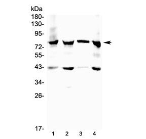 17-beta-Hydroxysteroid dehydrogenase 4 Antibody (HSD17B4)