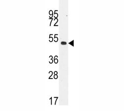 Desmin Antibody