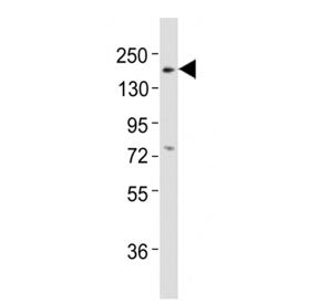Western blot testing of Erbb3 antibody at 1:2000 dilution + mouse lung lysate; Predicted band size :