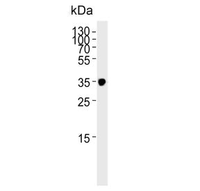 IFNGR2 Antibody / IFN gamma Receptor beta