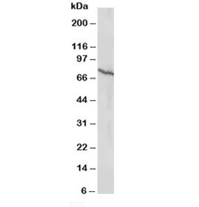 Estrogen Receptor Antibody (beta)
