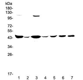 CKB Antibody / Creatine kinase B