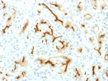 CFTR Antibody / Cystic Fibrosis Transmembrane Regulator