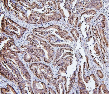 HSP105 Antibody / HSPH1