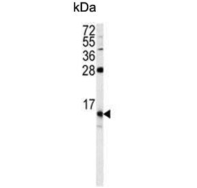 FKBP1B Antibody