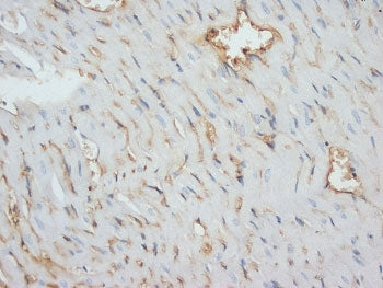 Desmin Antibody