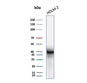 Western blot testing of human HDLM-2 cell lysate using recombinant PD-L1 antibody (clone rCD274/8195