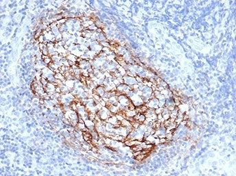 IHC staining of FFPE human tonsil tissue with CD35 antibody (clone CR1/6385) at 2ug/ml. HIER: boil t