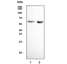 ATE1 Antibody / Arginine-tRNA--protein transferase 1