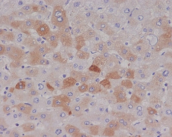 C Reactive Protein Antibody / CRP