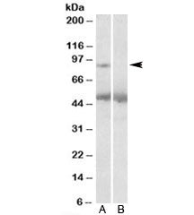 USP6 Antibody