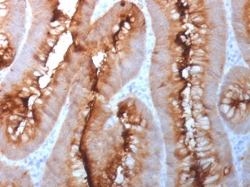 CEA Antibody / Carcinoembryonic Antigen