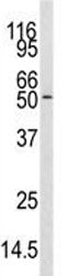 CAMKK Antibody