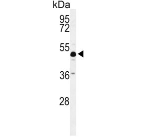 Western blot testing of mouse cerebellum tissue lysate with ANKH antibody. Predicted molecular weigh