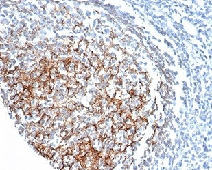 IHC staining of FFPE human tonsil tissue with CD35 antibody (clone CR1/6378) at 2ug/ml. HIER: boil t