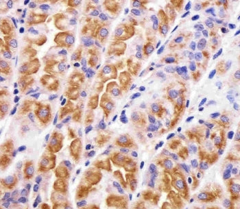 VAMP-8 Antibody