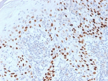p40 / p63 delta Antibody