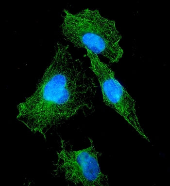 VEGF Receptor 1 / VEGFR1 Antibody / FLT1