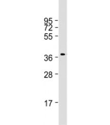 RASSF2 Antibody