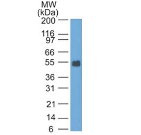 Western blot testing of rat colon lysate with EpCAM antibody. Expected molecular weight: ~35 kDa (un