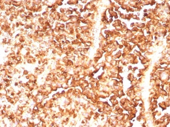 S100A1 Antibody