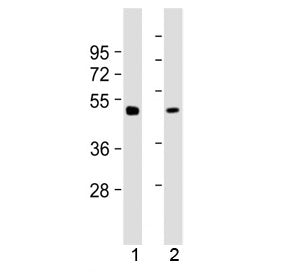 Gamma Tubulin Antibody / Tubg2
