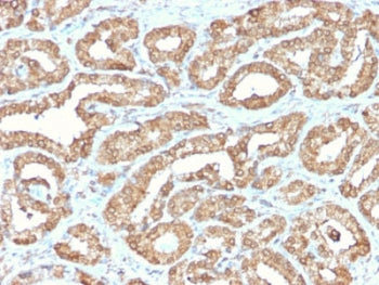 Ornithine Decarboxylase Antibody / ODC1