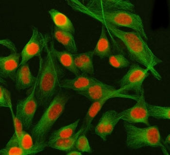 PSIP1 Antibody / PC4 and SFRS1-interacting protein / LEDGF