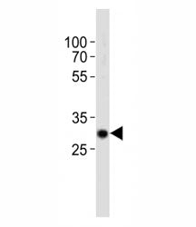 Western blot analysis of lysate from mouse kidney tissue using Hes1 antibody diluted at 1:1000. Pred