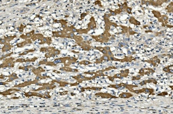 CYP2C19 Antibody / Cytochrome p450 2C19