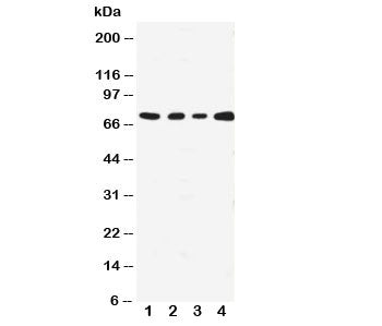 MEKK3 Antibody
