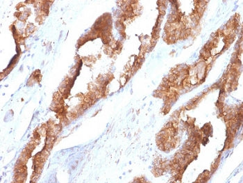HSP27 Antibody / HSPB1