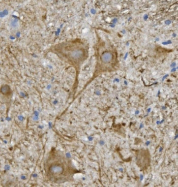 Neurofilament Antibody (-Light) / NF-L / NEFL