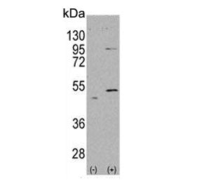 ALDH5A1 Antibody