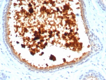 Mammaglobin A Antibody / SCGB2A2
